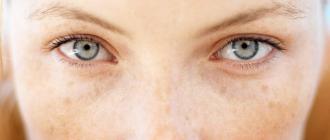Manchas de pigmento debajo de los ojos: causas con fotos y cómo deshacerse de ellas.