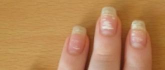 Nails bloom: why and why